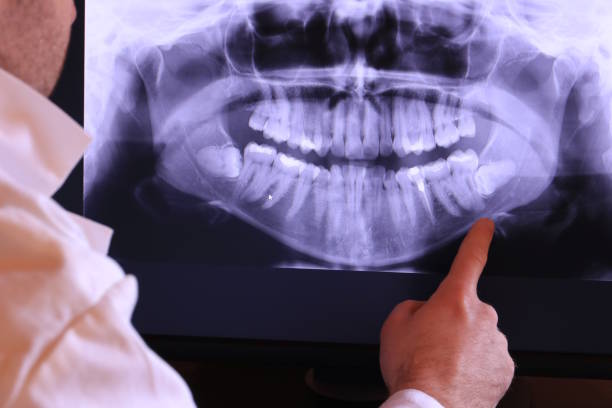 Best Cracked Tooth Emergency Dentist  in Wallace, FL